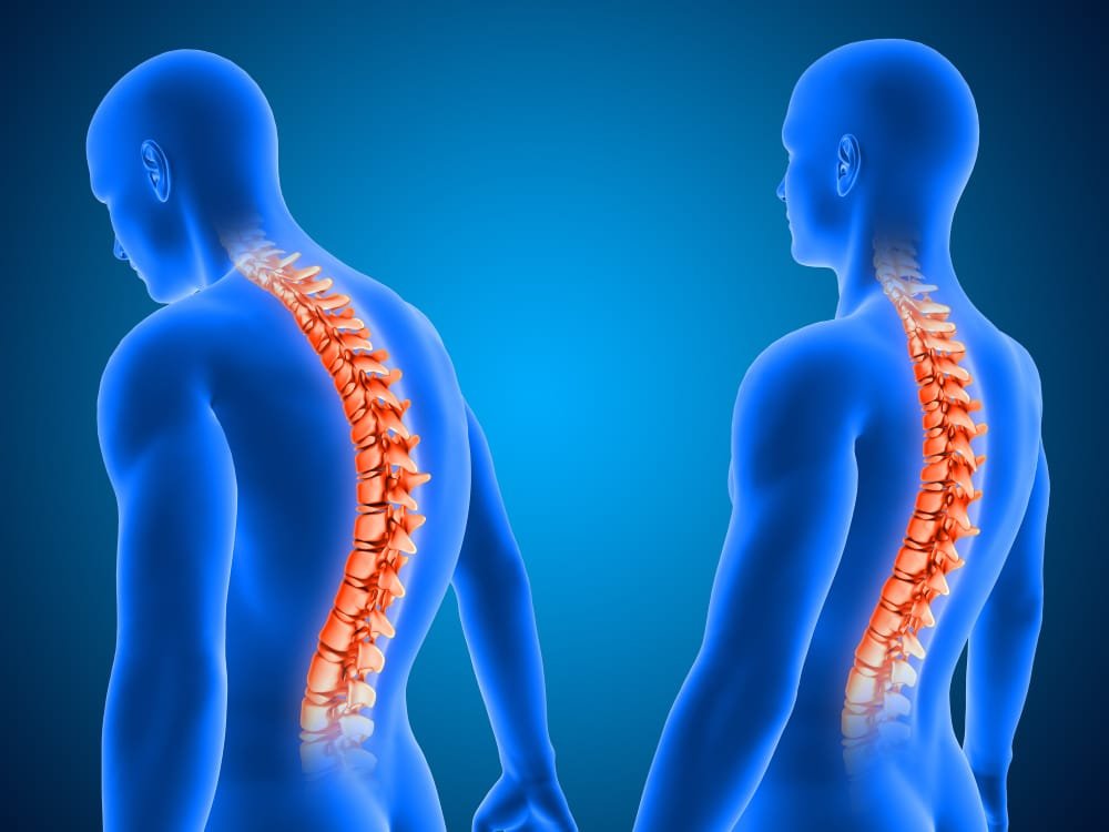 Can Spine Rehabilitation Help You Regain Mobility and Live With Less Pain?